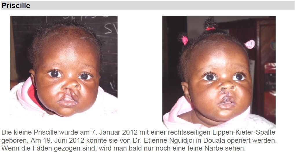 Kamerun-2012-Cleft
