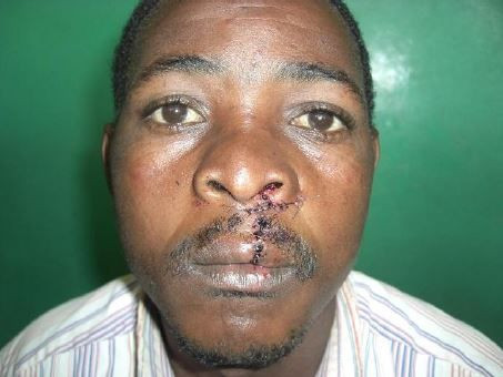 Ruanda-2013-Cleft