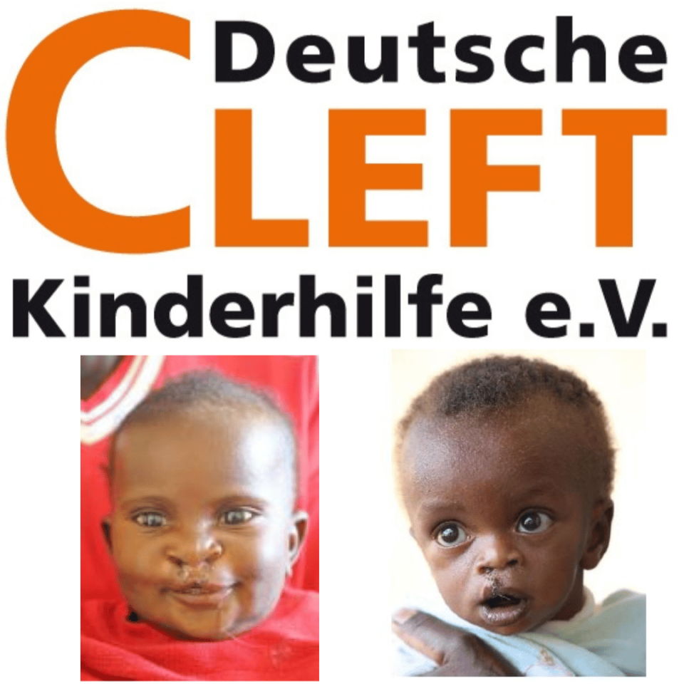 Cleft-Vestine-und-Dany-2014